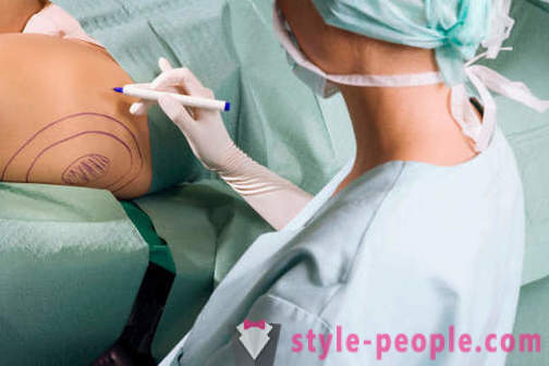 Os cirurgiões plásticos destruir estereótipos sobre seu trabalho
