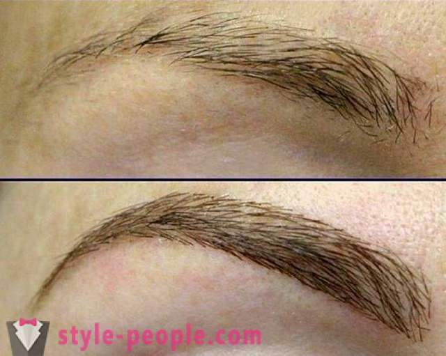 Método de cabelo acúmulo sobrancelha. Benefícios, custos e disponibilidade