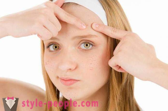 Máscaras de acne em casa. máscara eficaz para acne